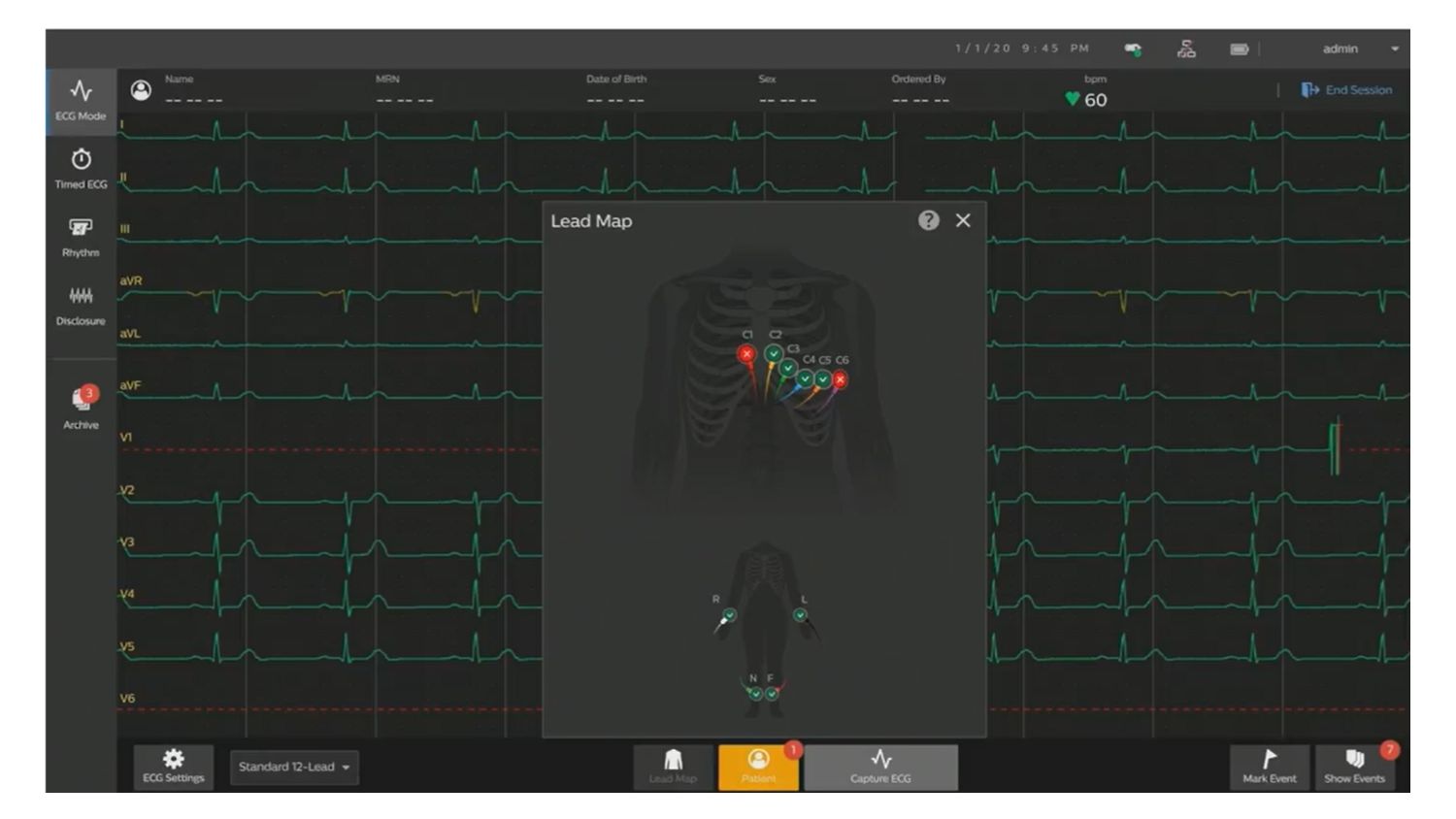 HRS 2025 Partner Pulse Cardiac Workstation Video