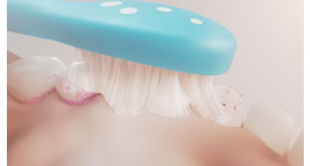 Un nettoyage en douceur pour protéger les dents des enfants