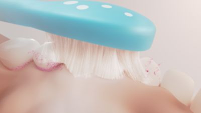 Gentle cleaning to protect growing smiles