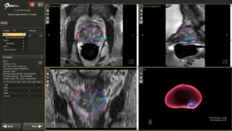 View clinical data prior to biopsy for added confidence