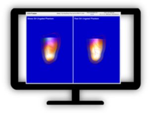 NM Emory Cardiac Toolbox (ECTb) HeartFusion Evaluate fused coronary anatomy