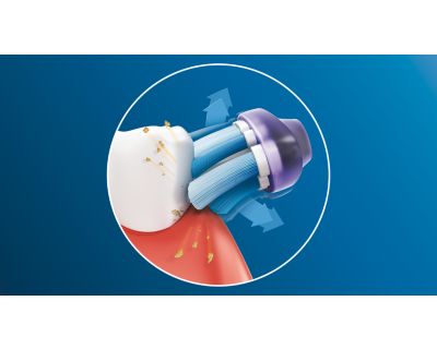 Powerful plaque removal
