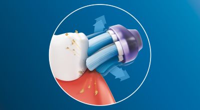Up to 10 x more plaque removal than a manual toothbrush