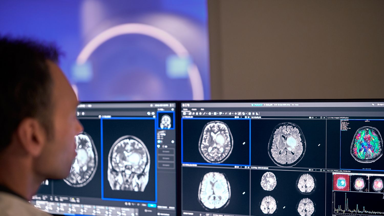 MRI console showing large high resolution images on two screens