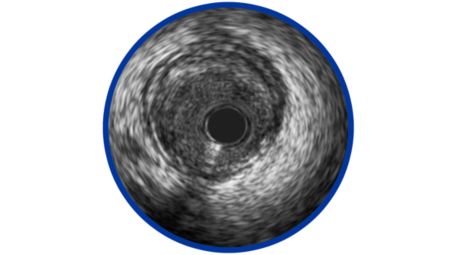 45 MHz-frequency imaging