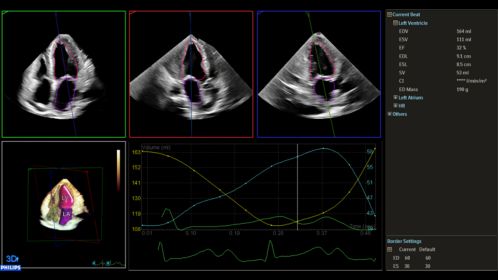 Ultrasound Workspace Dynamic Heart Model