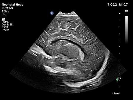mC12-3 Neonatal Head