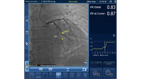 Understand patient anatomy and disease