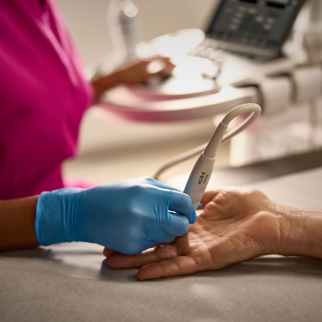 A close-up showing a clinician’s hand holding a transducer and conducting an ultrasound on a patient’s hand