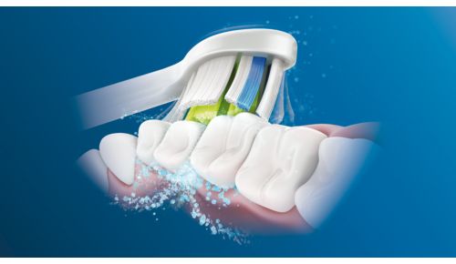 Avanzada tecnología sónica de Philips Sonicare