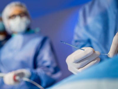 Clinician handling Philips Stellarex .035 drug-coated balloon catheter during vascular procedure