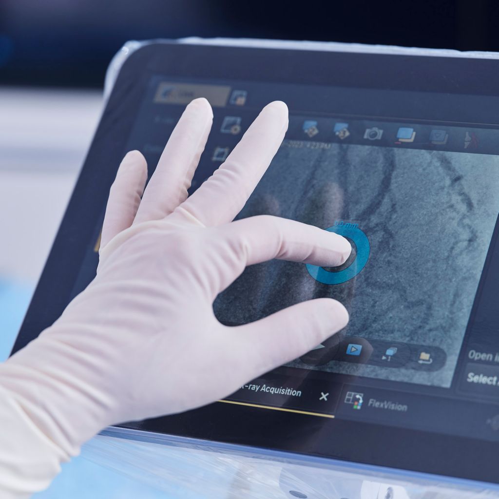 Image of clinicians zooming in on a screen during a procedure 