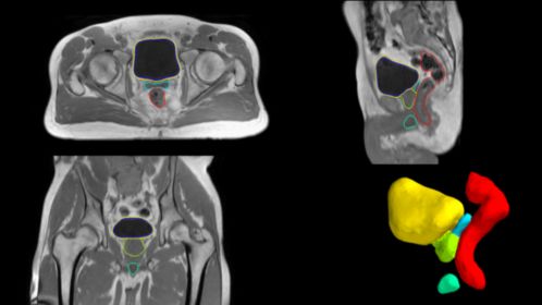 Image of Reti-EB247600-Picxy