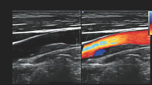Carotid artery-dual display