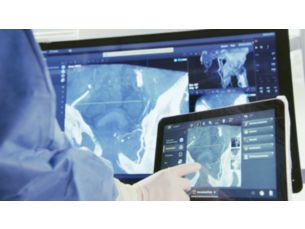 Xper Software de reconstrucci&oacute;n 3D