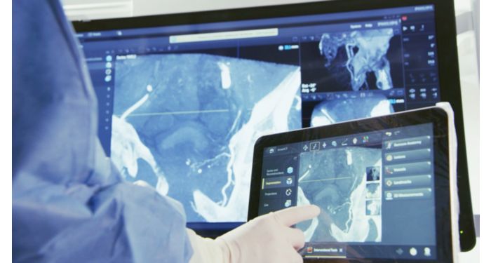 Smart CT Soft Tissue  Быстрое получение КТ-подобных изображений высокого разрешения при интервенционных вмешательствах