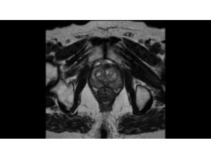 SmartSpeed Body - Pelvis MR Clinical Applications