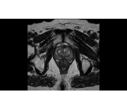 SmartSpeed - Pelvis