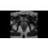 SmartSpeed - Pelvis thumbnail