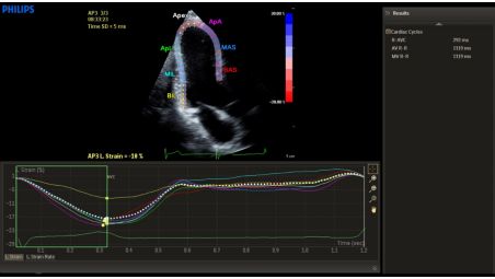 QLAB quantification software to expand diagnostic information