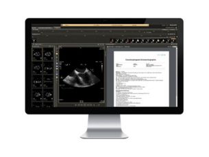 IntelliSpace Cardiovascular Solução multimodalidade de gerenciamento de imagens e informações