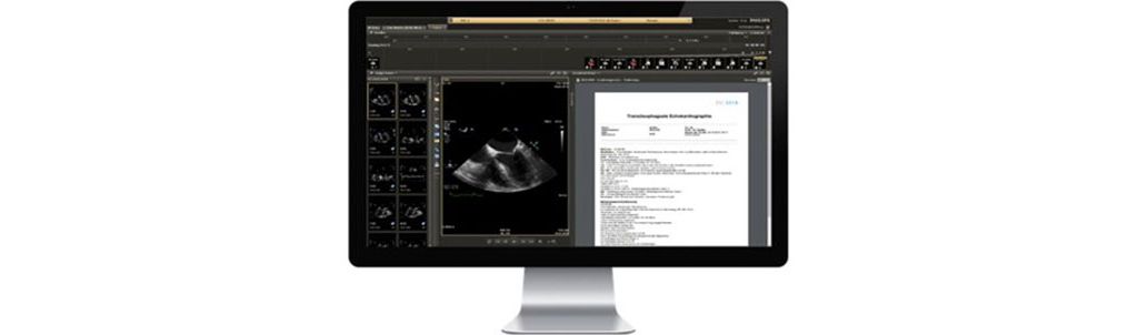 Cardiovascular Workspace Image and Information Management Solution
