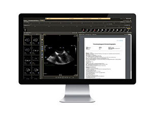 IntelliSpace Cardiovascular System do zarządzania obrazami i informacjami pochodzącymi z różnych systemów obrazowania