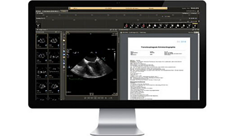 IntelliSpace Cardiovascular Multi-modality image and information management solution