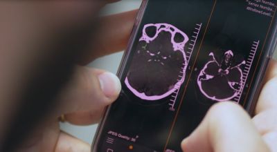 StrokeViewer video thumbnail