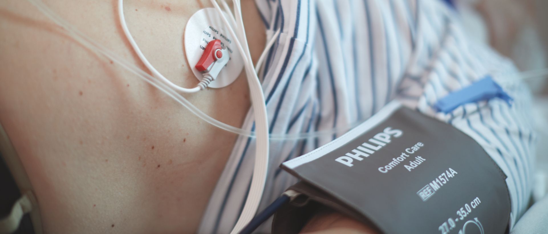 patient connected to ecg leads, electrodes and nbp cuff
