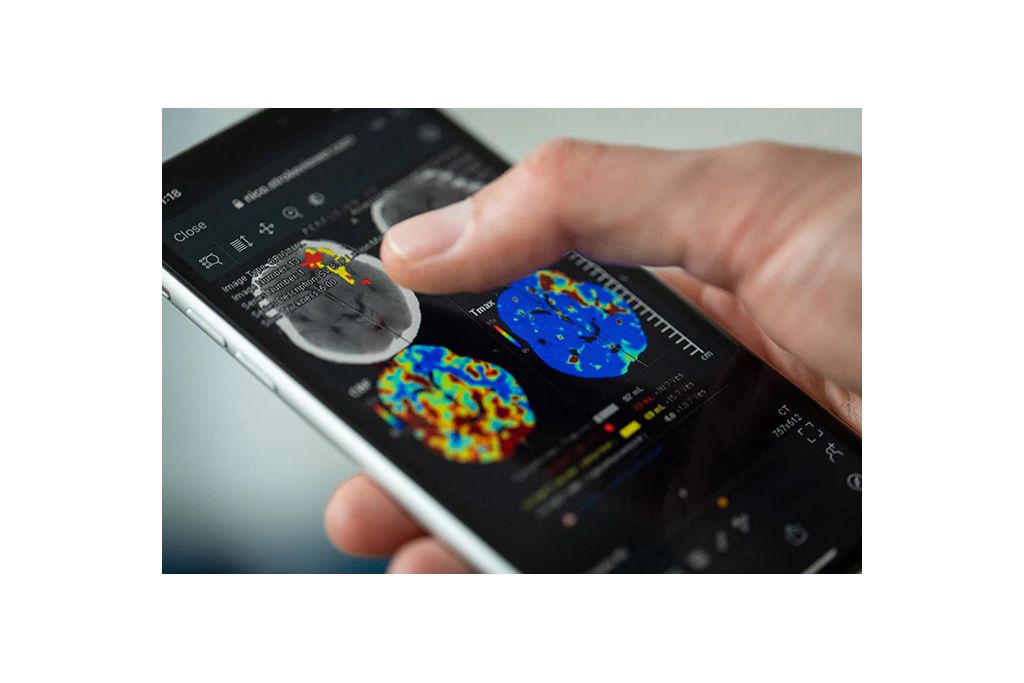 stroke viewer