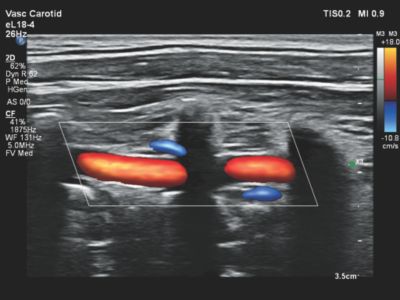 Ultrasound web Flow Viewer