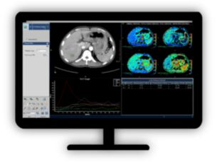 CT Body Perfusion Quantifiable perfusion​