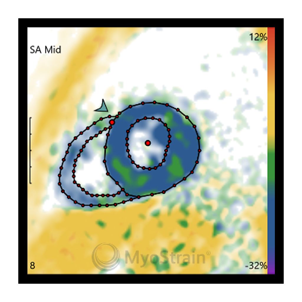 Fast-SENC clinical image