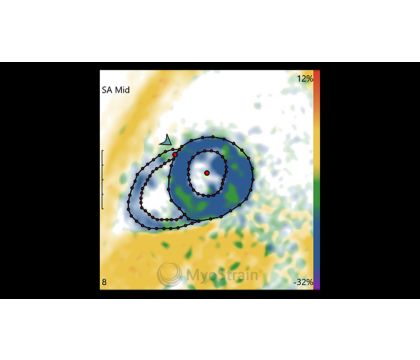 Philips SENC image