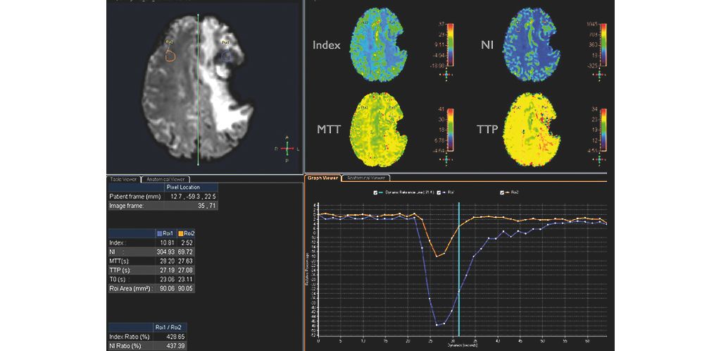 Axial T2* Perfusion