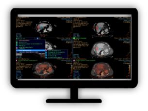 CT Spectral Tumor Tracking Inspection of tumors, as contrast enhanced, soft tissue oriented, and whole-body scans