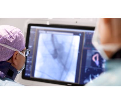 Philips HeartNavigator Insightful planning and guidance for Structural Heart Procedures