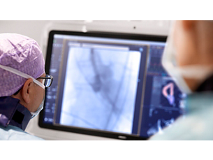 HeartNavigator Planejamento e orientação informados para procedimentos estruturais de doença cardíaca