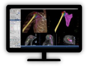 CT Acute Multi-Functional Review One application for the assessment of selected anatomies