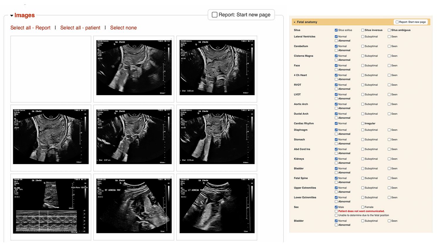 FetView patient report