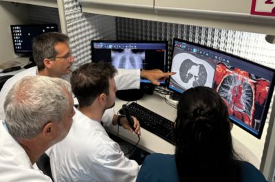 Equipo de médicos en Argentina revisa tomografías computarizadas de pulmón