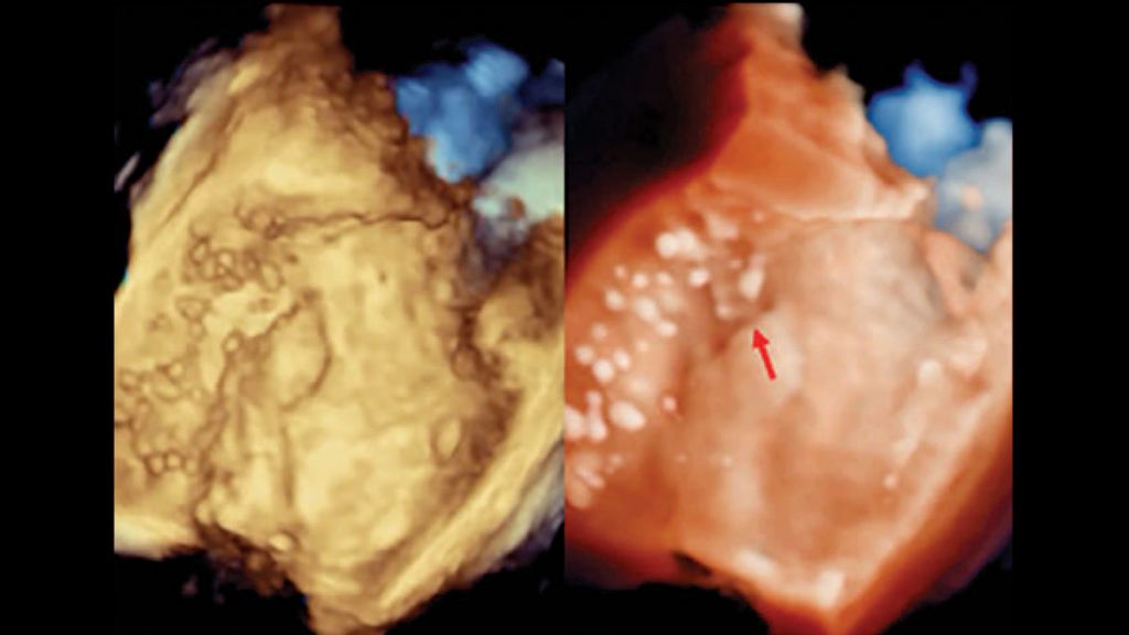 Clinical image - TrueVue