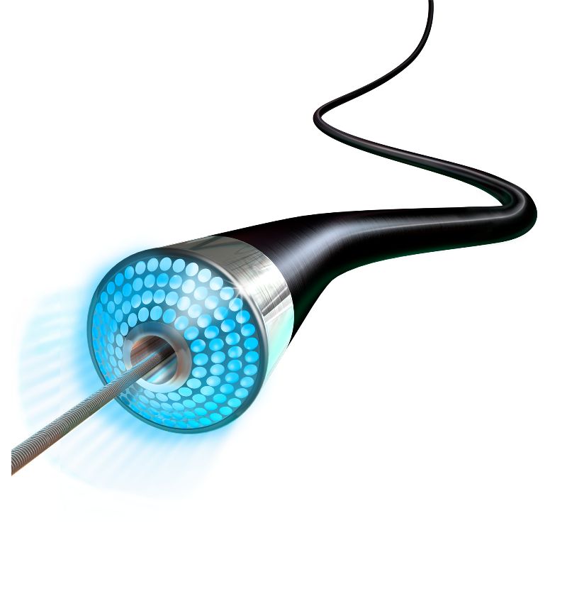 Turbo Elite — Laser Atherectomy Catheter