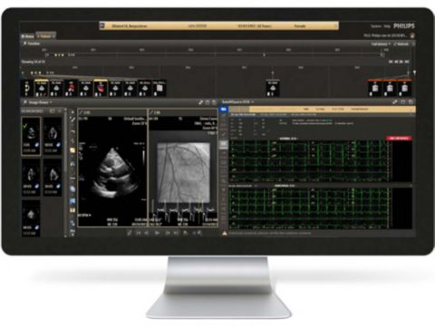 IntelliSpace Cardiovascular monitor screen