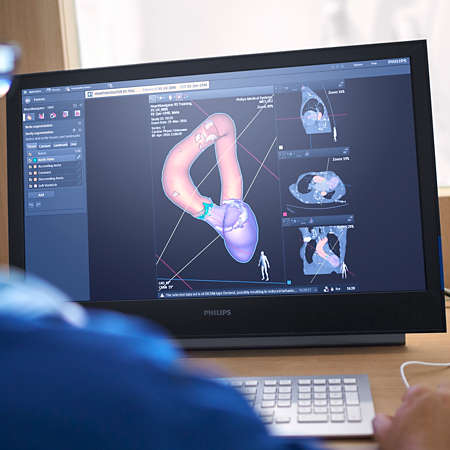 Heartnavigator Philips