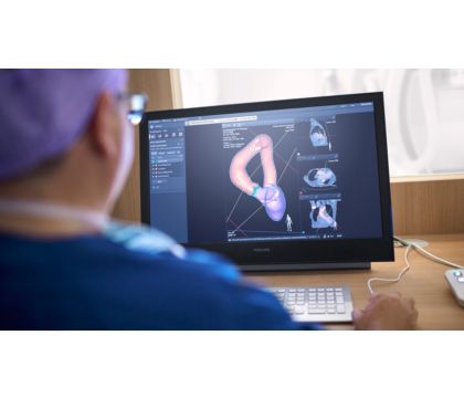 Philips Azurion control room TAVR planning with heartNavigator