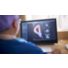 Philips Azurion control room TAVR planning with heartNavigator thumbnail