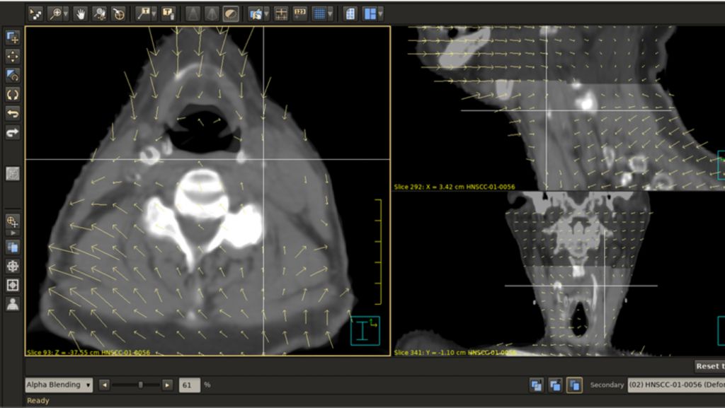 Multimodality Simulation Workspace provides multiple tools for rigid and deformable image registration.