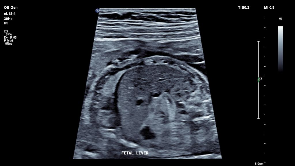 Fetal Liver -eL18-4